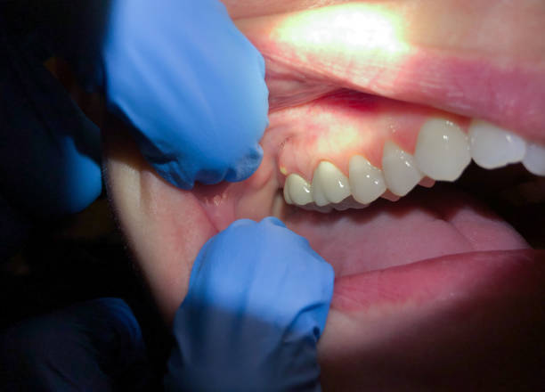 Best 24-Hour Emergency Dental Care in Craigsville, WV