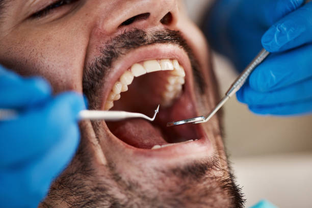 Best Broken or Chipped Tooth Repair in Craigsville, WV